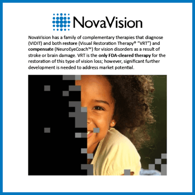 Novavision