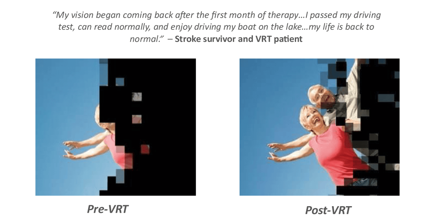 pre-post-vrt