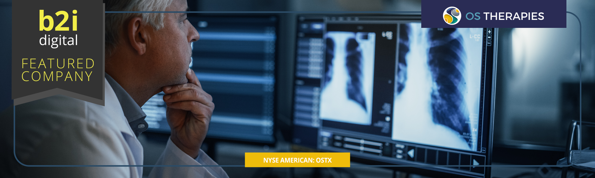 B2i Digital Featured Company: OS Therapies Initiates FDA BLA Filing for OST-HER2 to Prevent or Delay Recurrent Pulmonary Metastatic Osteosarcoma